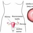Клінічні ознаки вагітності Запальні процеси і інфекції